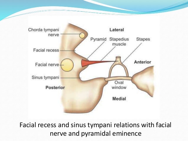 facial nerve recess Facial nerve recess